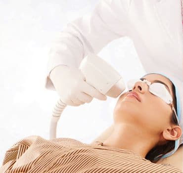 Laser Hair Removal in Indiranagar